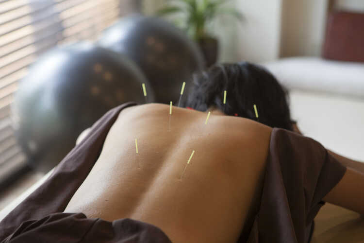 Acupuncture & Integrative Medical Center